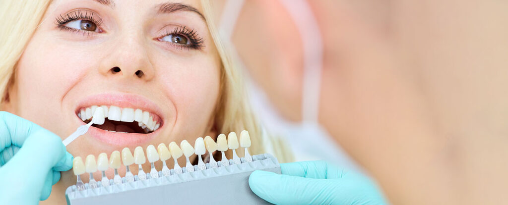 Tooth Whitening