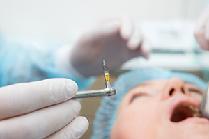 A dental implant surgery